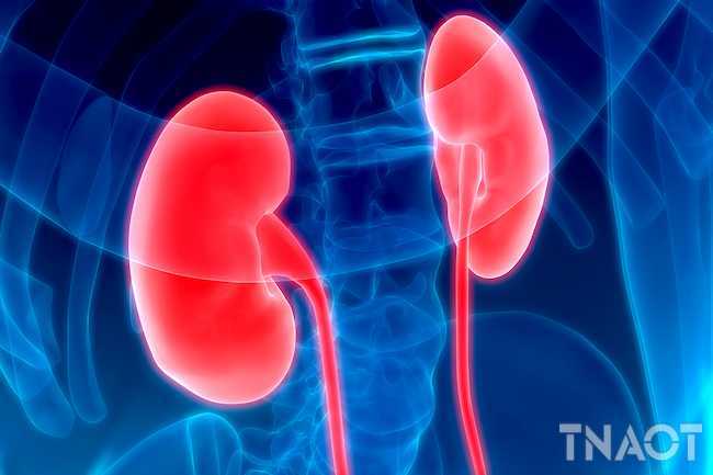 493ss_thinkstock_rf_human_kidneys_x-ray.jpg